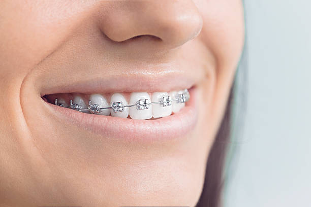 Best General Dentistry  in Cedar Crest, MA